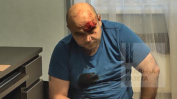 Скандал в «ЛНР»: «МГБ» наехало на Иванющенко, Ахметова и Катунина