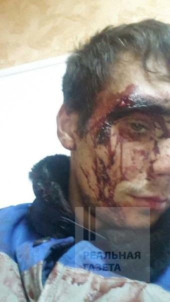 В Липецкой области беженцев из Донбасса избили местные жители (фото)