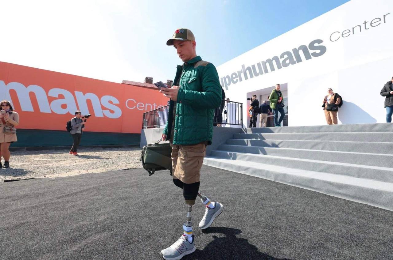 Беруть найскладніші випадки. Як переселенцям безкоштовно отримати надсучасні протези