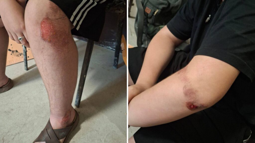 У Маріуполі на окупованій території група кавказців напала на підлітка: і заявила, що “це наша земля”