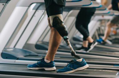 Виготовлення протезів стало найприбутковішим напрямом серед підприємств на окупованій Луганщині