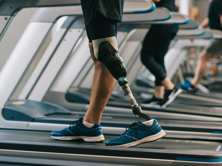 Виготовлення протезів стало найприбутковішим напрямом серед підприємств на окупованій Луганщині