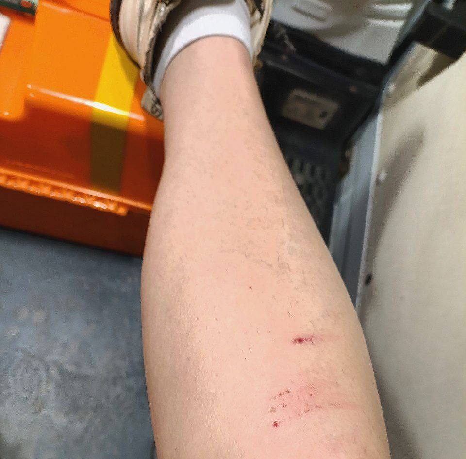 У Луганську на дівчину напала зграя собак. Її госпіталізувли